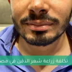 تكلفة زراعة شعر الذقن في مصر